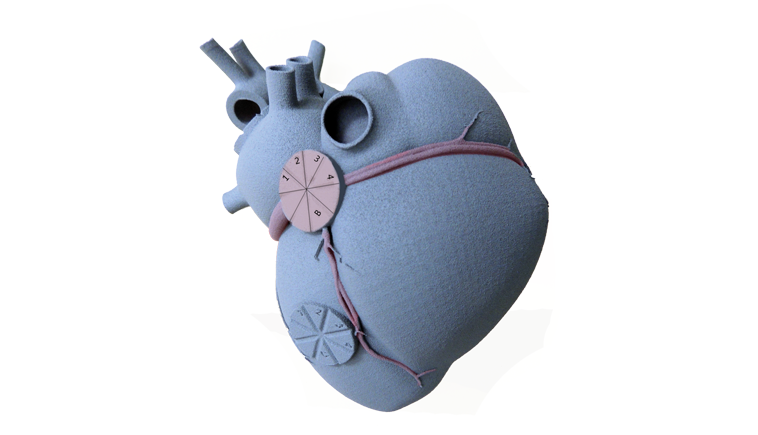 Herz im 3D-Druck